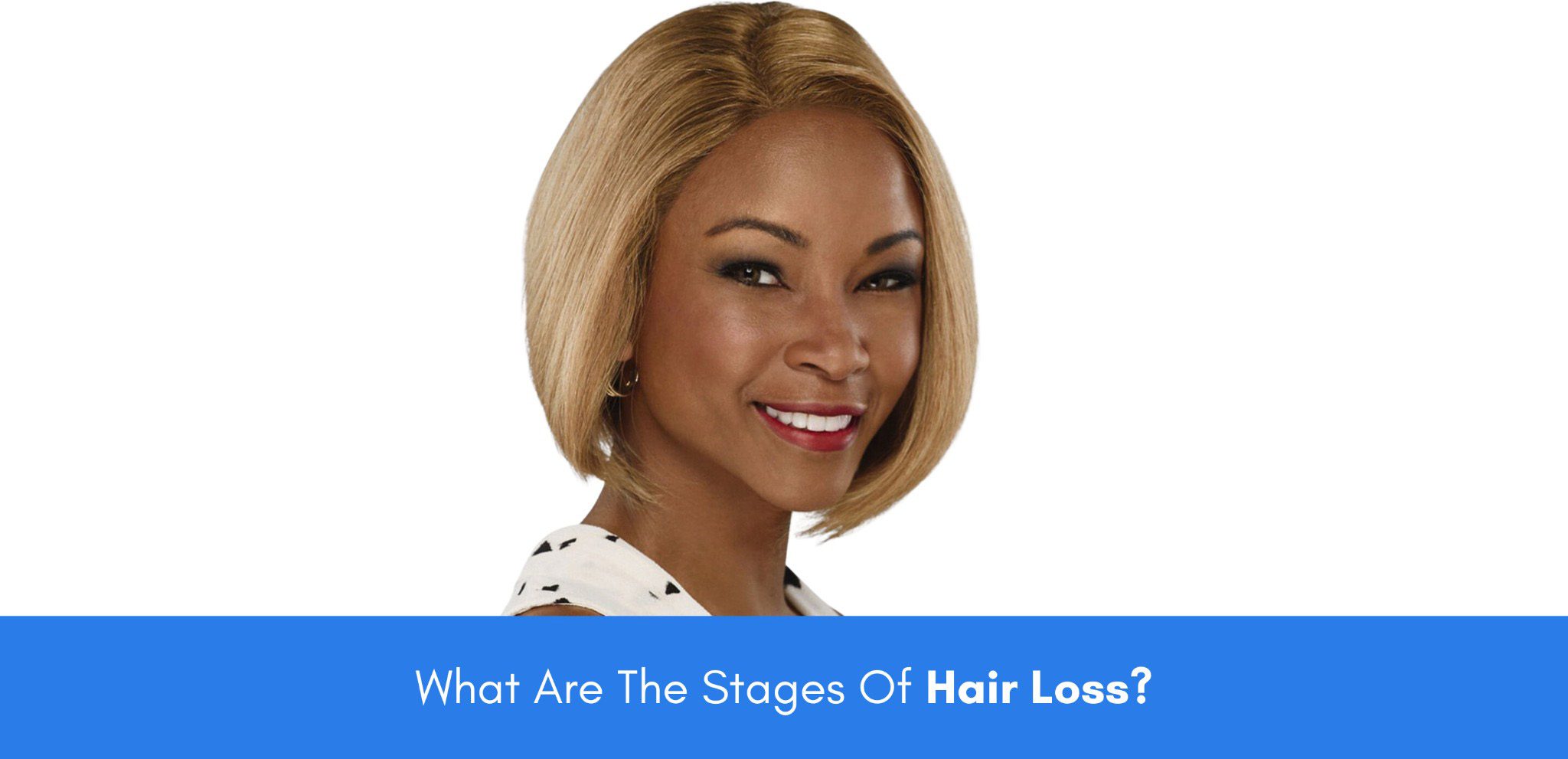 what are the stages of hair loss